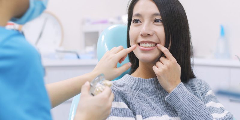 Dental Implants